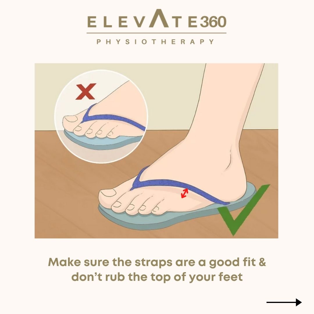 Are FlipFlops Bad for My Feet? Elevate Physiotherapy