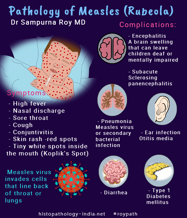 Hand foot and mouth or chicken pox Symptoms and Signs of Chickenpox vs