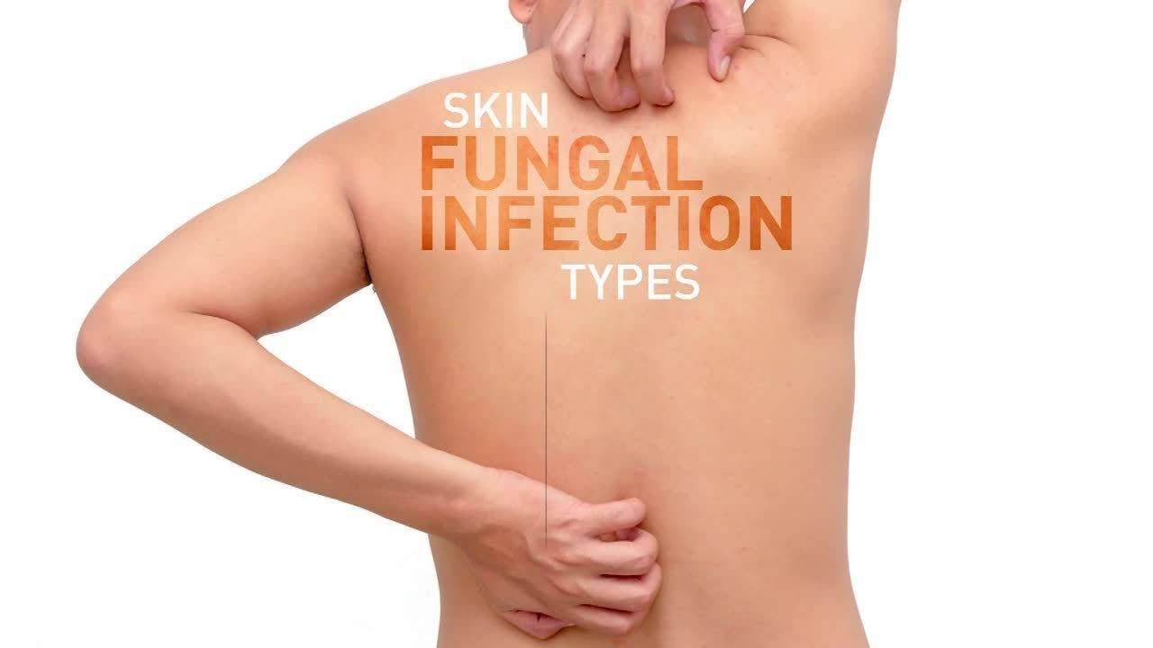 Rash under skin folds Risk Factors, Causes, Symptoms, and Treatment