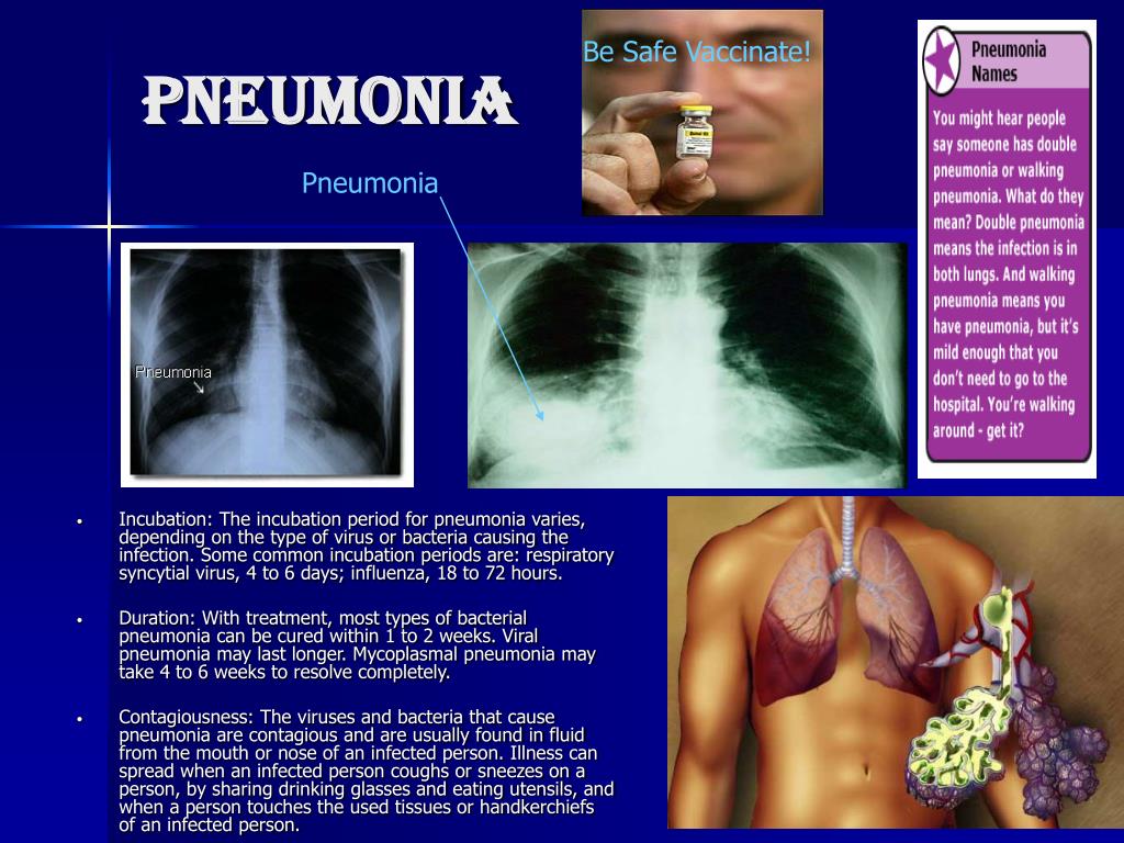 Types of bacteria that cause pneumonia Causes of Pneumonia CDC