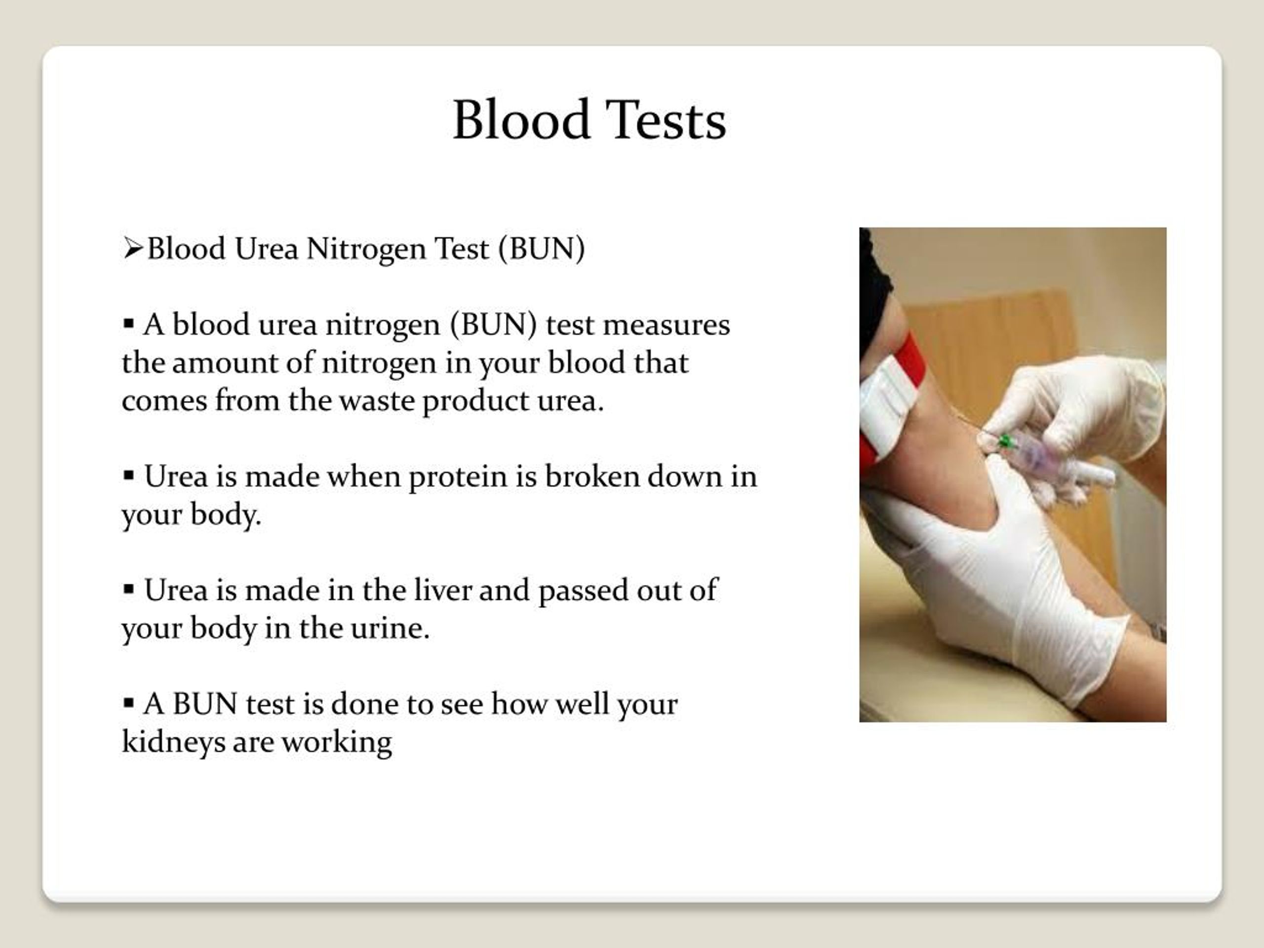 Low creatinine serum and high bun creatinine ratio BUN/Creatinine