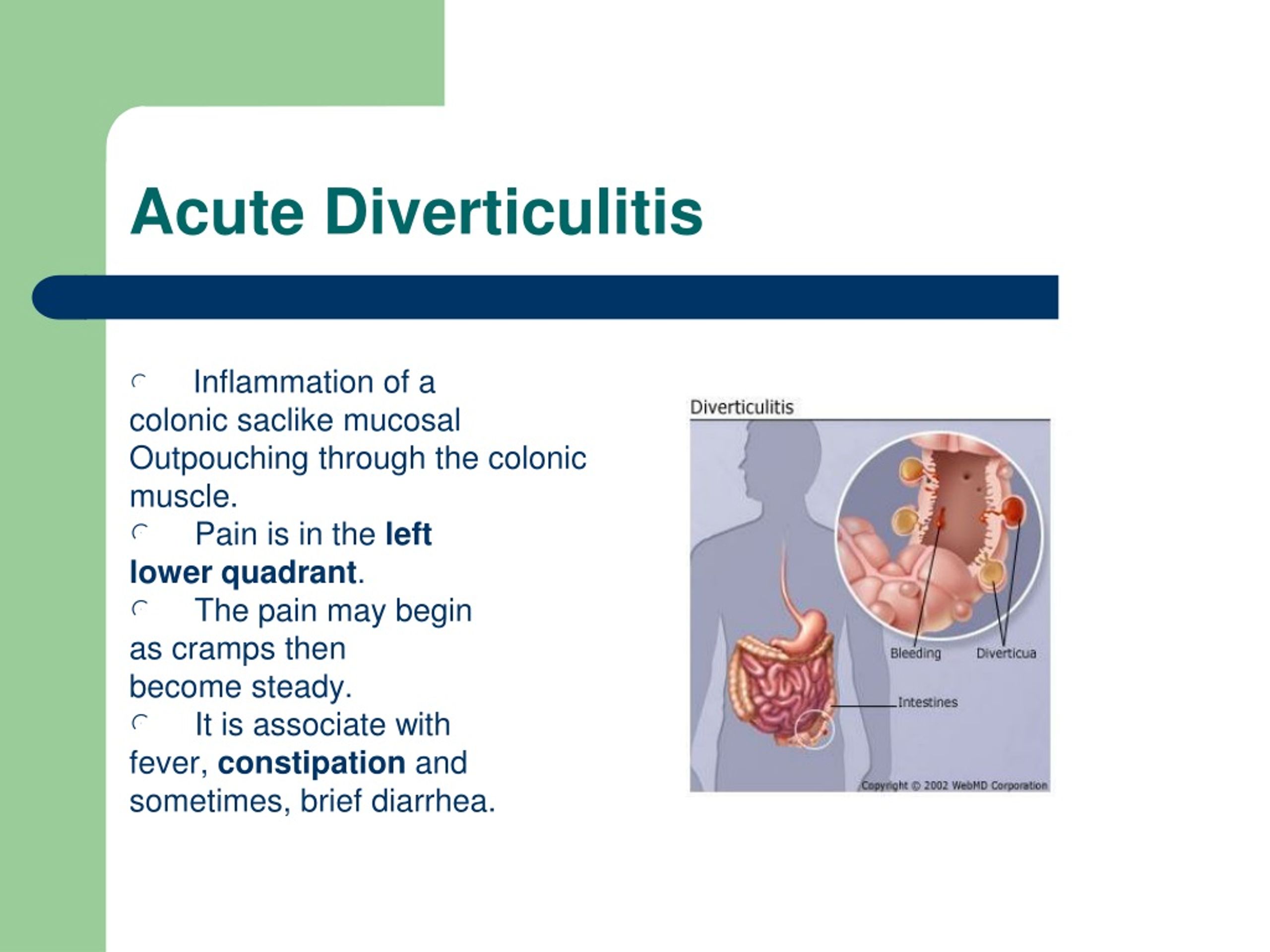 Lower left abdominal pain diverticulitis Diverticulitis Symptoms and