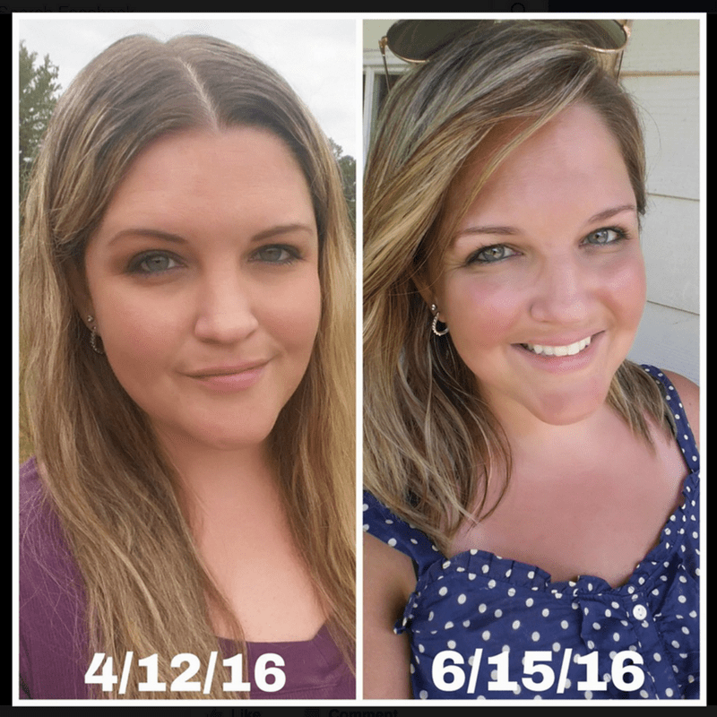 Weight loss hypothyroid treatment Does Treatment of Hypothyroidism Lead to Weight Loss