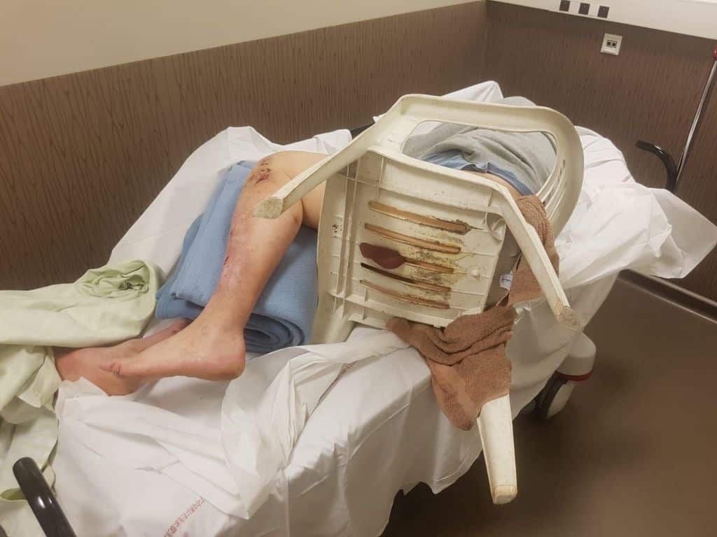 Man Gets Balls Stuck in Plastic Chair During Lockdown Elite Readers