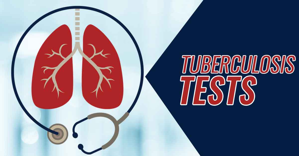 Who Should Get a TB Test and Why?