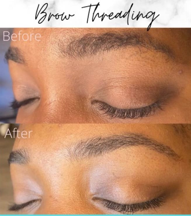 Before + After Elite Chicago