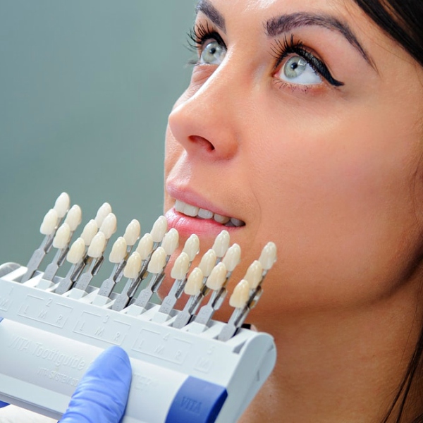 Dental Veneers in Orlando, FL Elite Dentistry