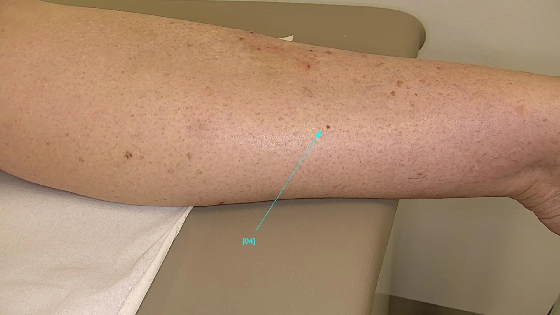 The power of technology in skin cancer detection