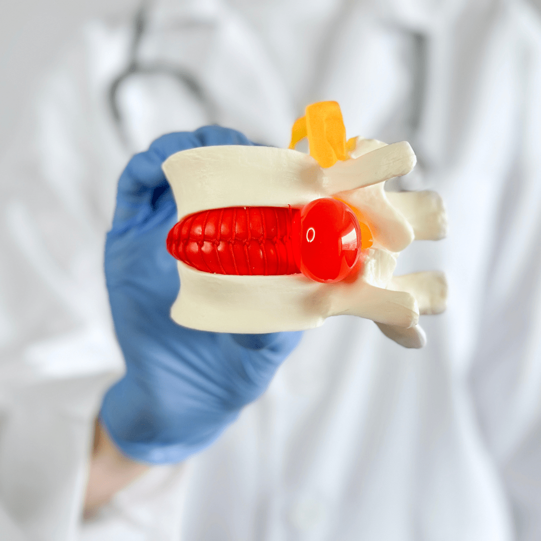 Disc Herniation Elite Spine & Health Center