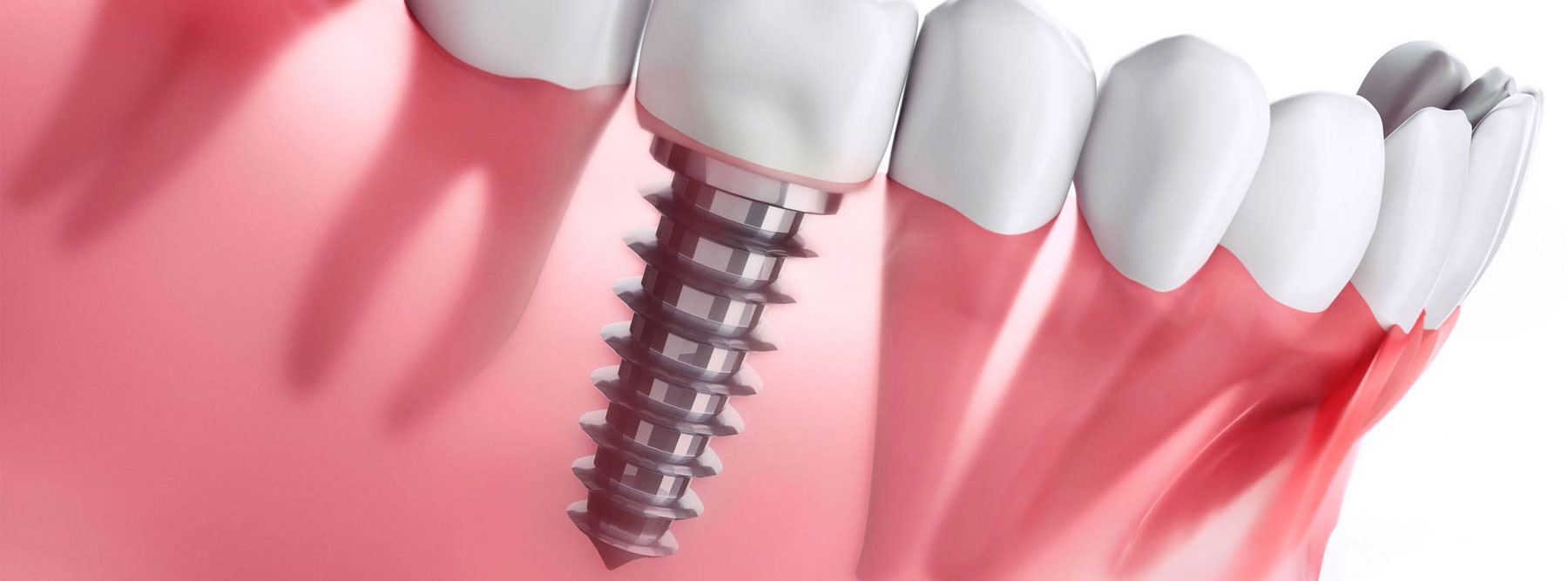 Ellicott City Smiles