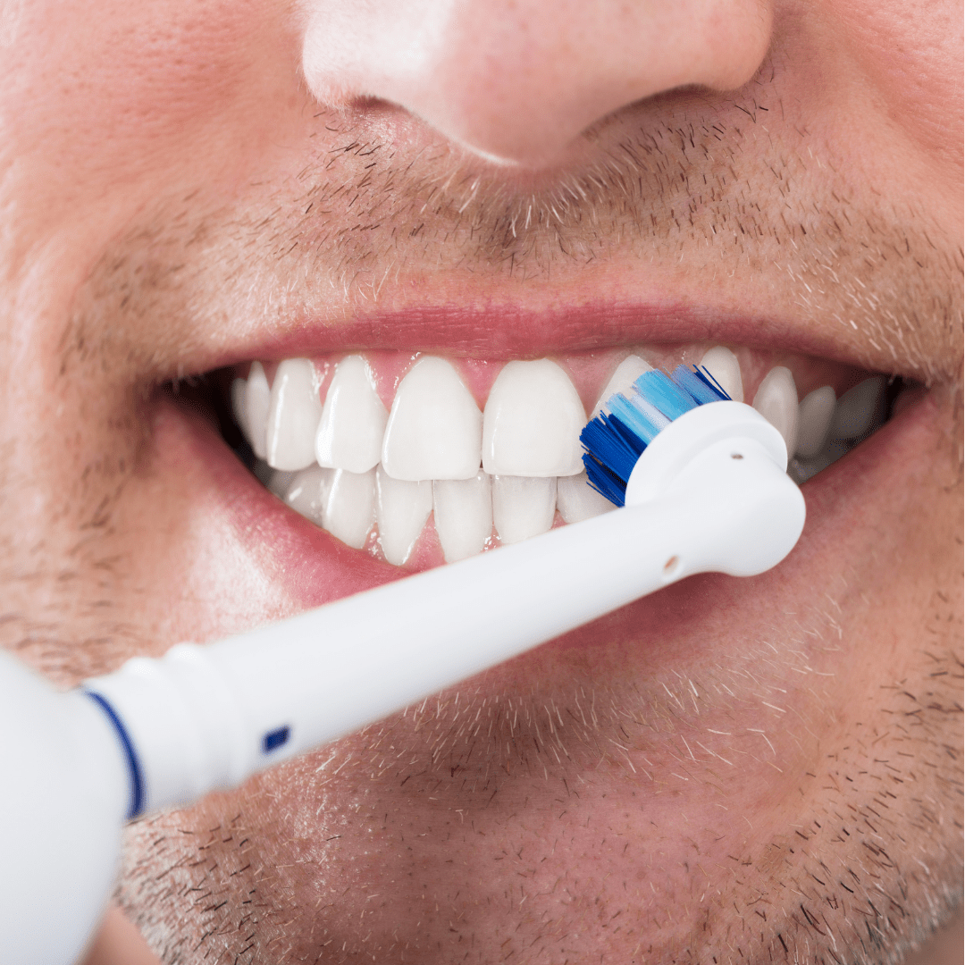 What are the Benefits of Using an Electric Toothbrush?