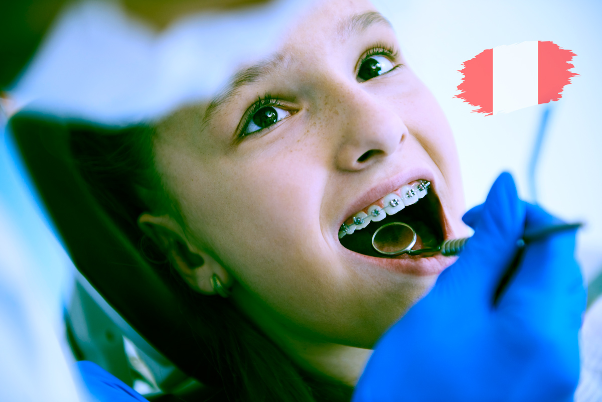 ¿Cuánto cuesta ponerse brackets? Diario El Perú