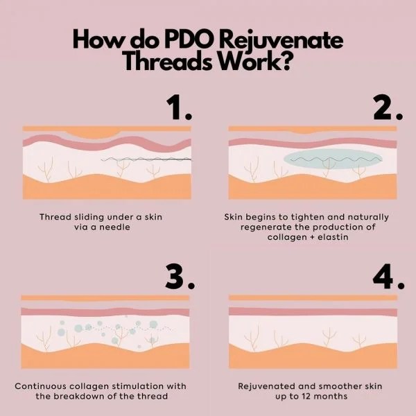 What are PDO Rejuvenate Threads? Elucell