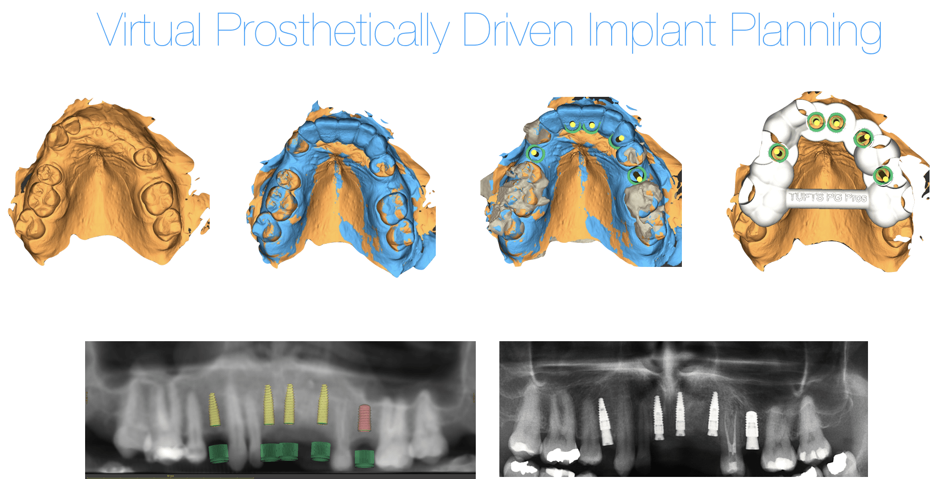 Dental implants in Rome Emanuele Cicero dentist in Rome