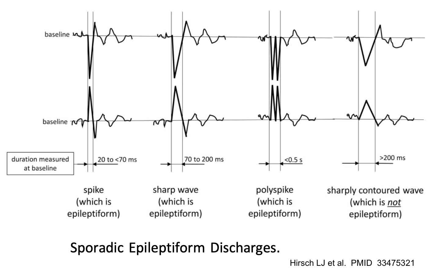 Eeg Machine Reading