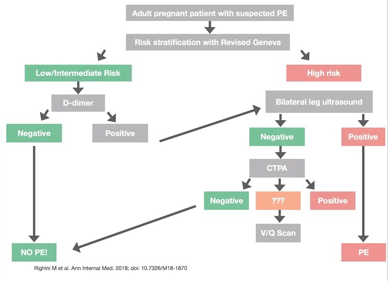 Pulmonary Embolism Workup in Pregnancy EM Cases Best Case Ever