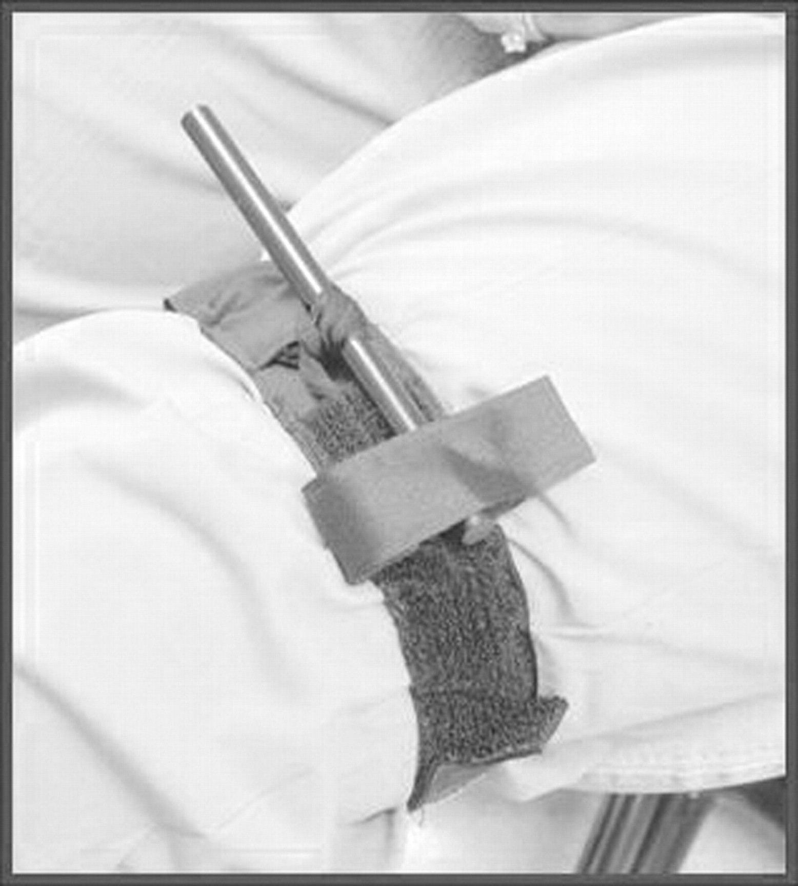 Tourniquet use in the civilian prehospital setting Lee et al. 24 (8) 584 Emergency