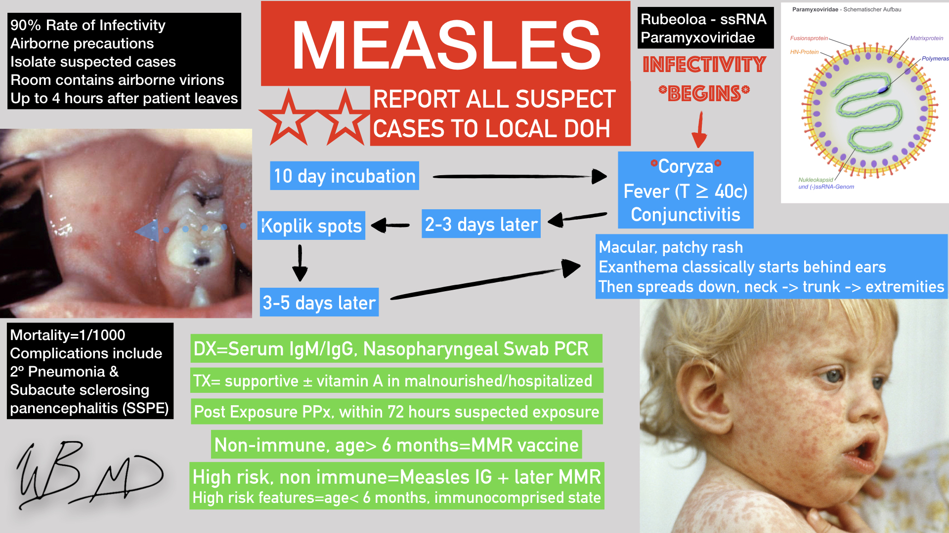 Measles Infographic