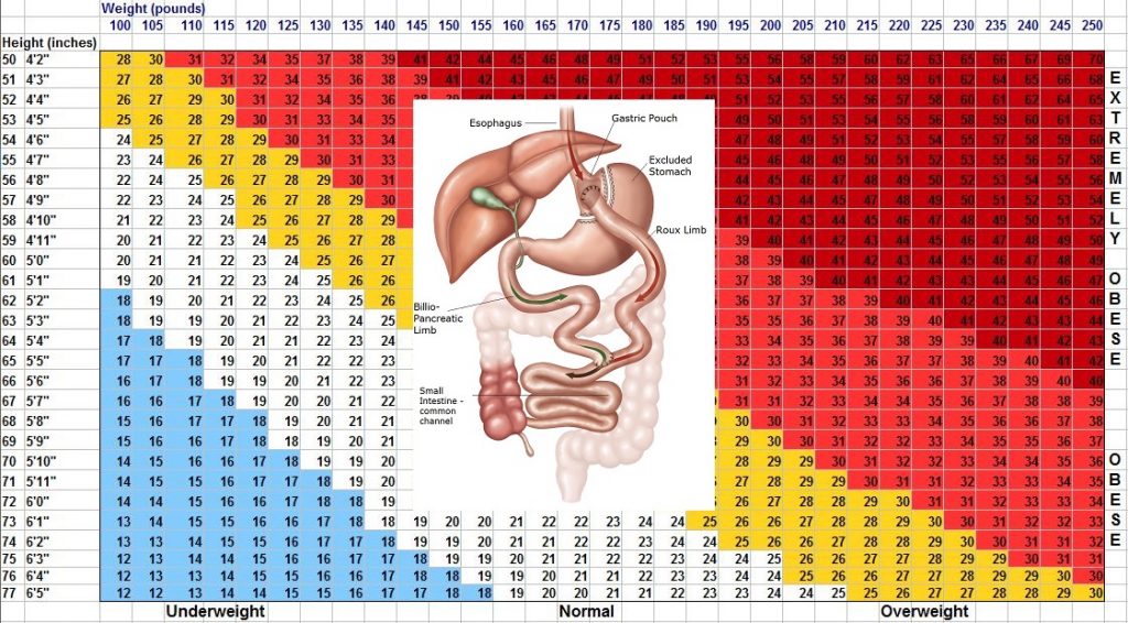 Learn More about BMI for Gastric Bypass Weight Loss Surgery Information