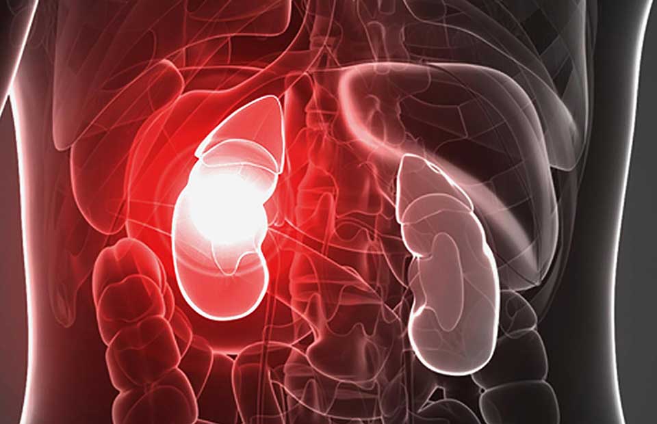 Kidney Transplant & Blood Pressure BEHBOUD INTERNATIONAL HOSPITAL