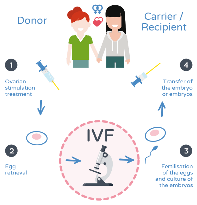Reciprocal IVF method Dexeus Mujer