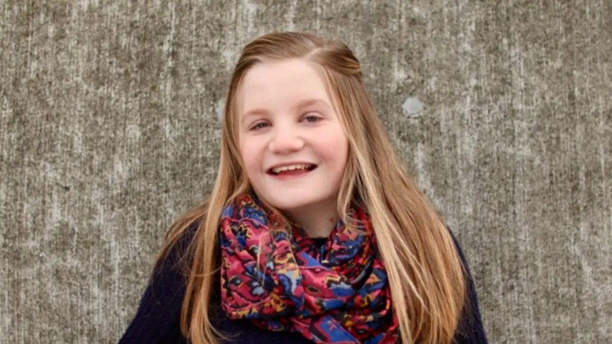 Turner syndrome 23 Important Symptoms, cause short stature