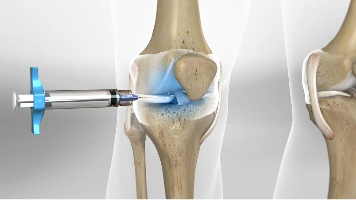 Knee Gel Injection Clinical Treatments and Necessary Care