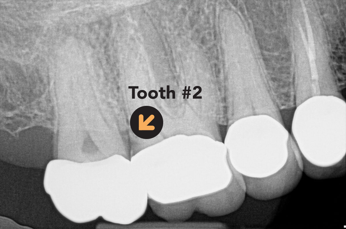 East Side Endodontics Technology