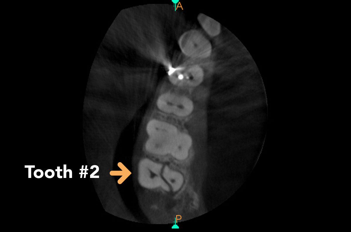 East Side Endodontics Technology