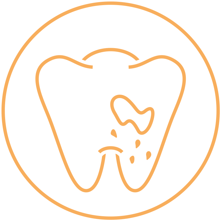 East Side Endodontics Services Offered