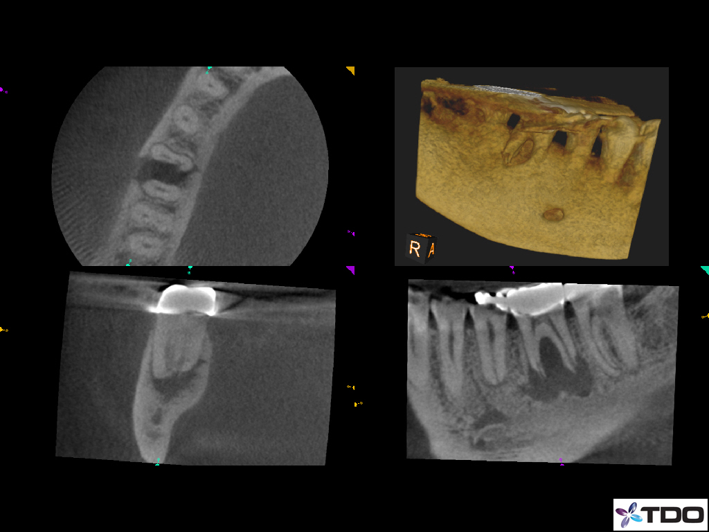 February 2020 The Myth of the Apical Constriction EndoExperience