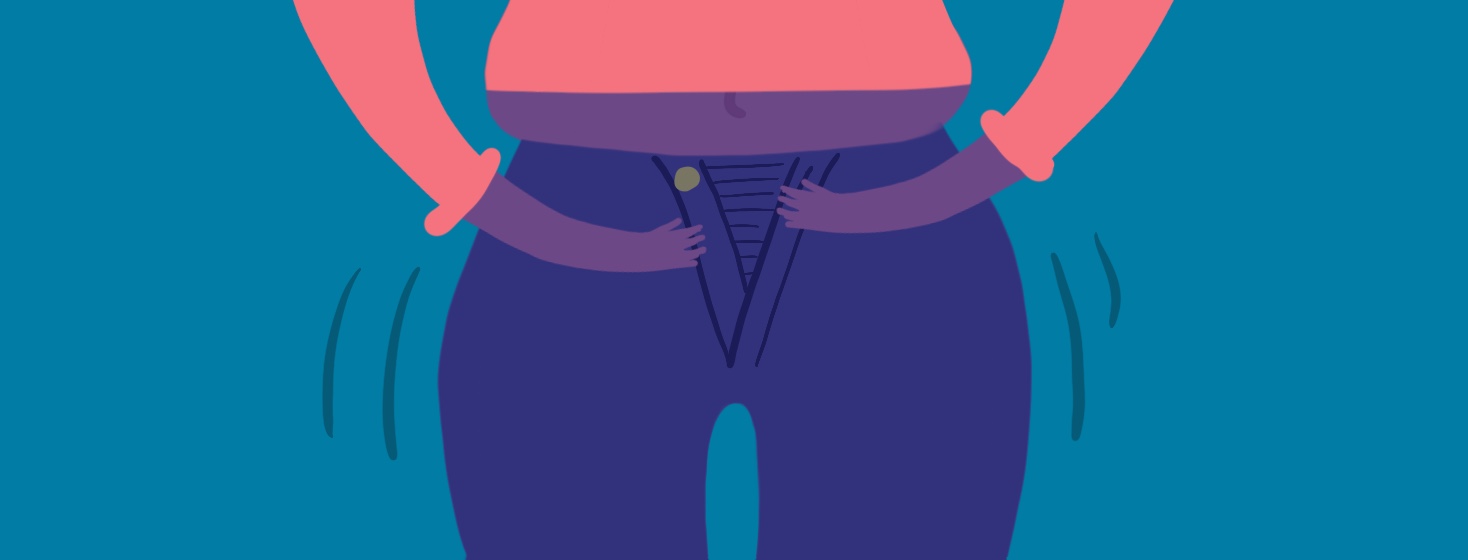 Endo belly What It Is, What Causes It, and How to Treat It