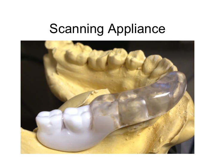CTGuided Surgery Chicago CT Guided Dental Implant