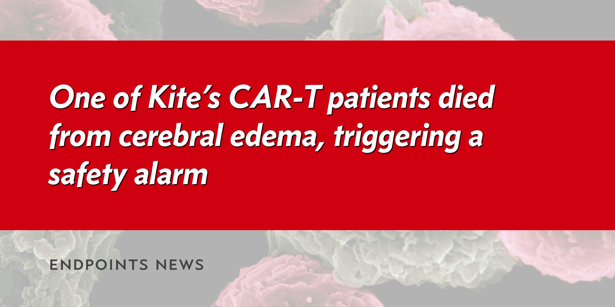 One of Kite Pharma’s CART patients died from cerebral edema