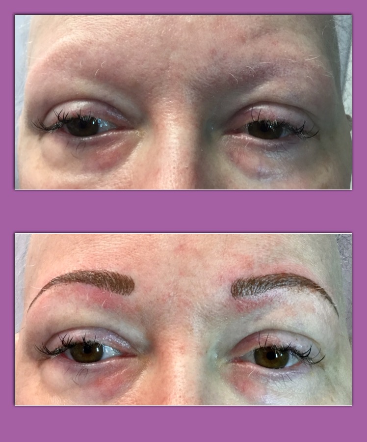 MicroBlading gives Brows Of Joy Enduring Esthetics