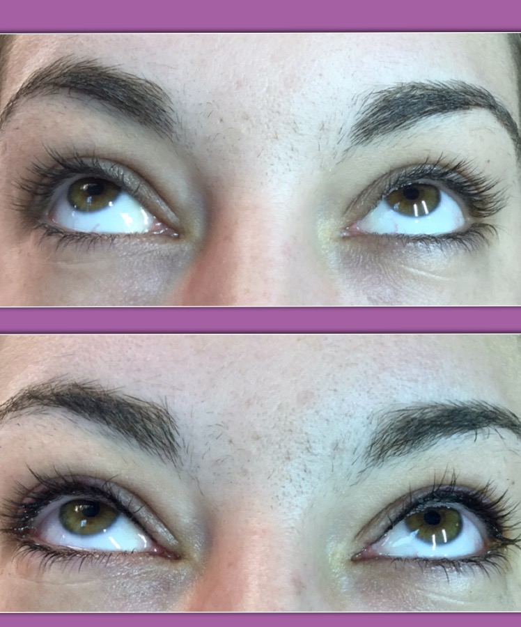 Permanent Eyeliner Enduring Esthetics