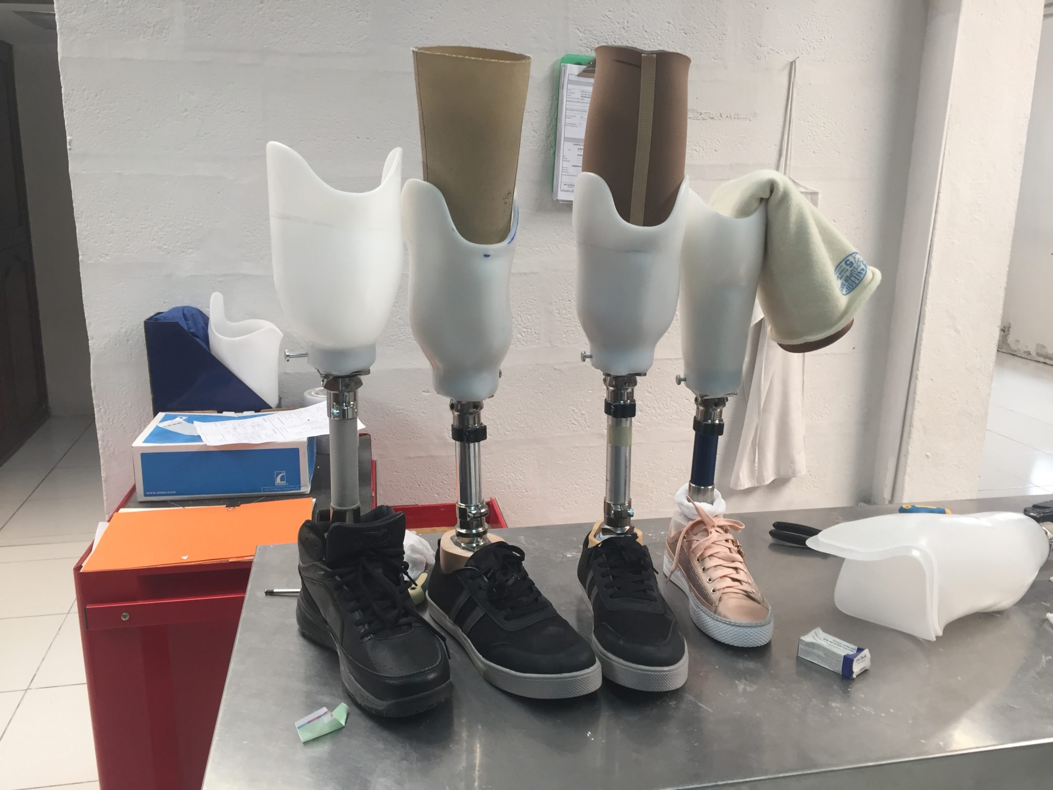 Summer program brings prosthetic care to amputees in Ecuador Walter