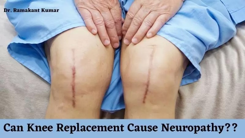 Can You Get Bursitis After Knee Replacement – Brandon.
