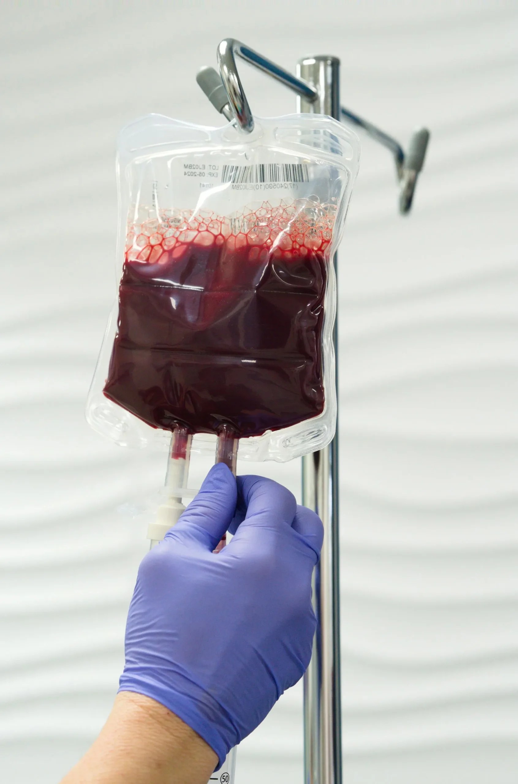 Ozone IV Therapy Phoenix, AZ Prolozone Injection Therapy