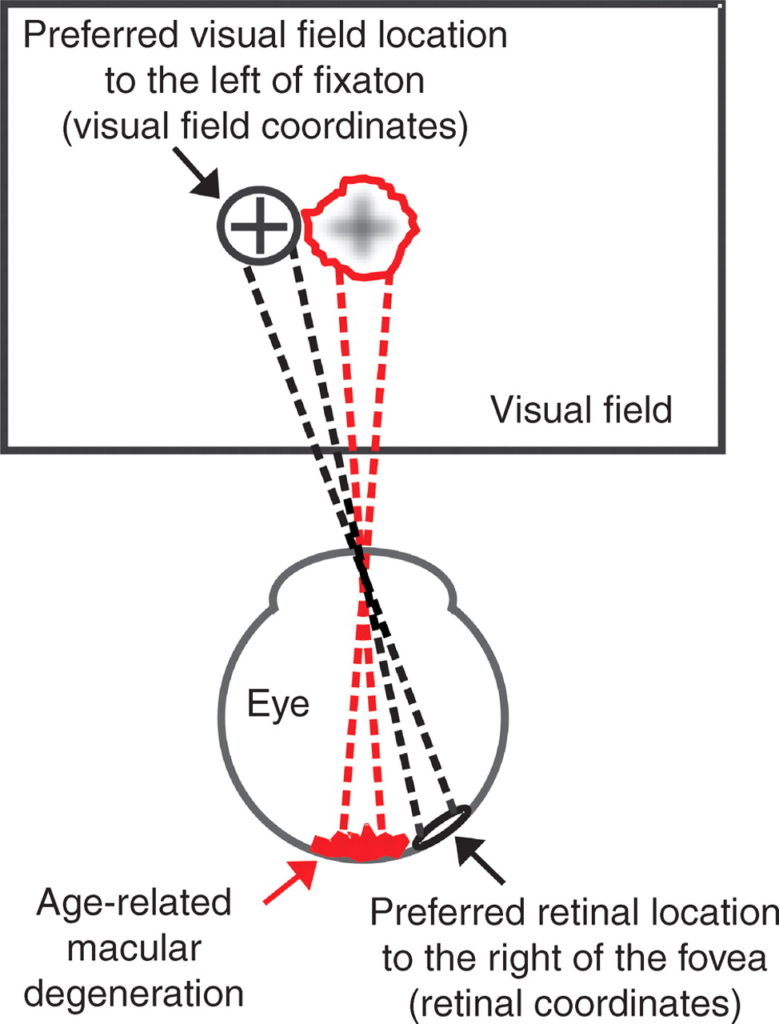 peripheral vision Ensight Skills Center