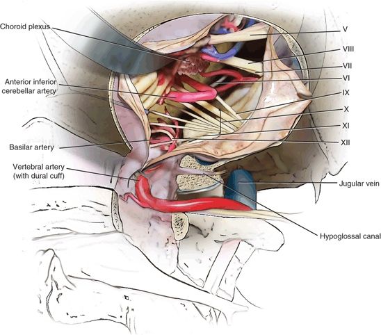 Far Lateral Transcervical Approach to the Lower Clivus and Upper