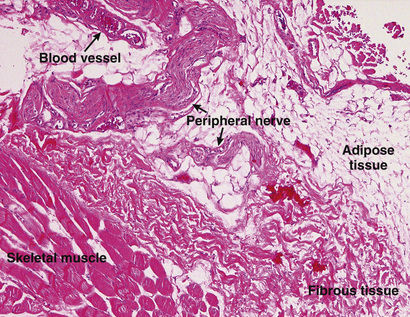 Pathology | Ento Key
