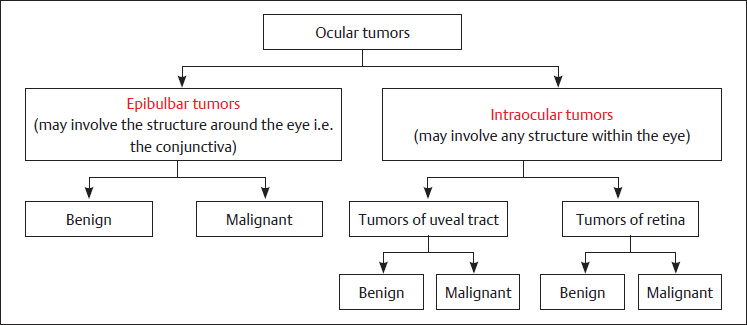 Ocular Tumors | Ento Key