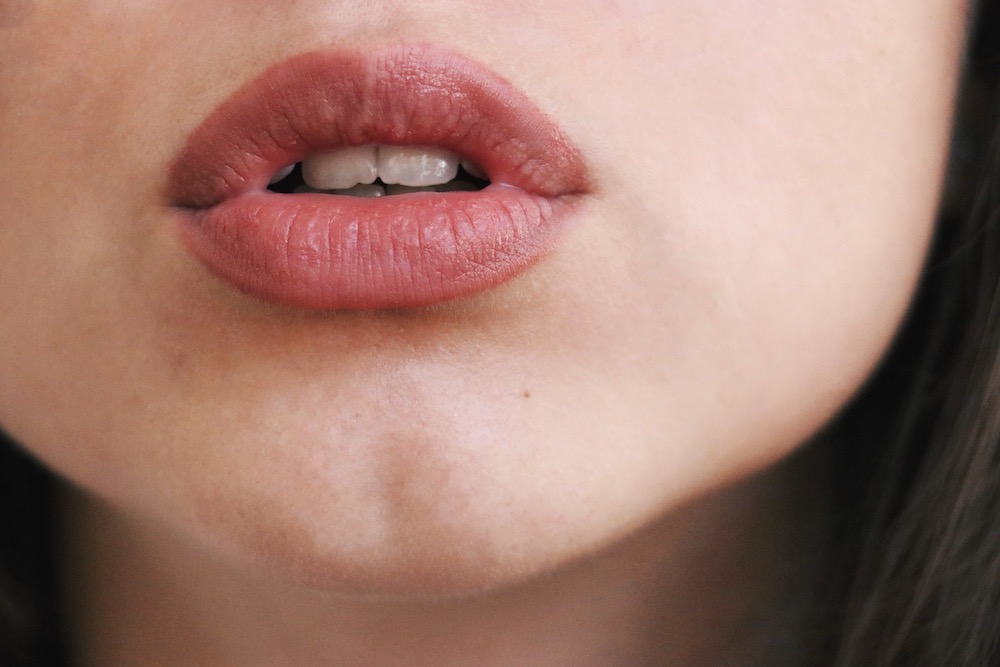 Lip Augmentation in Rochester, New York Envision Aesthetics