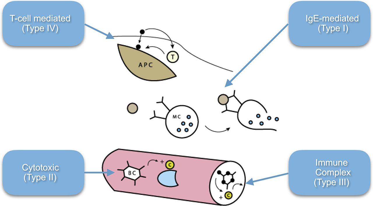 Fifteenminute consultation A child with a suspected drug allergy