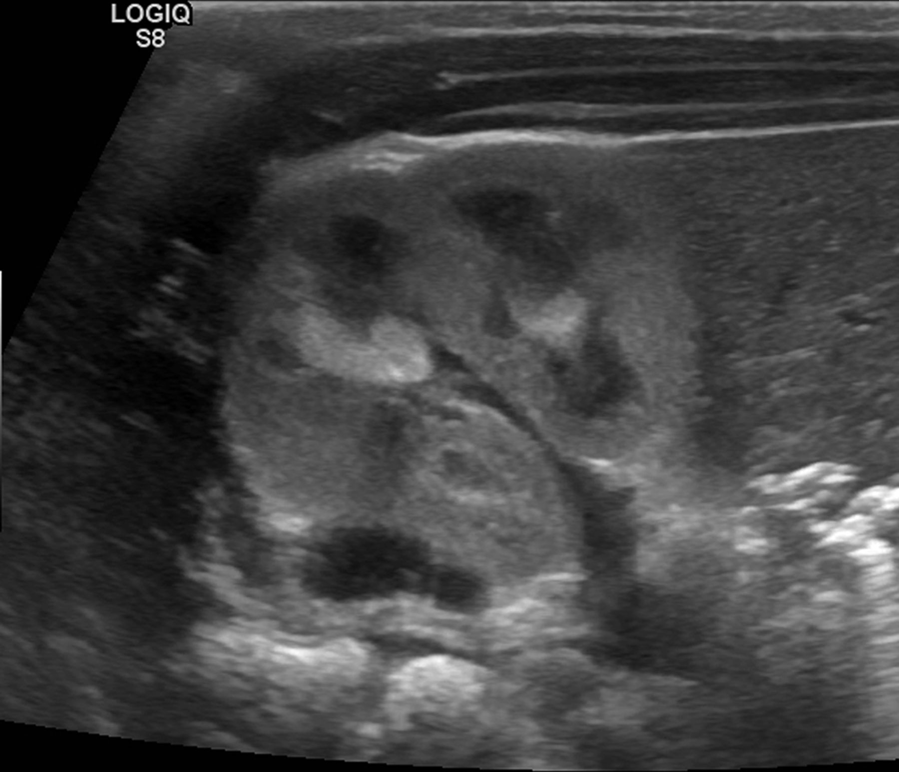 Puzzling pyramids ADC Education & Practice Edition