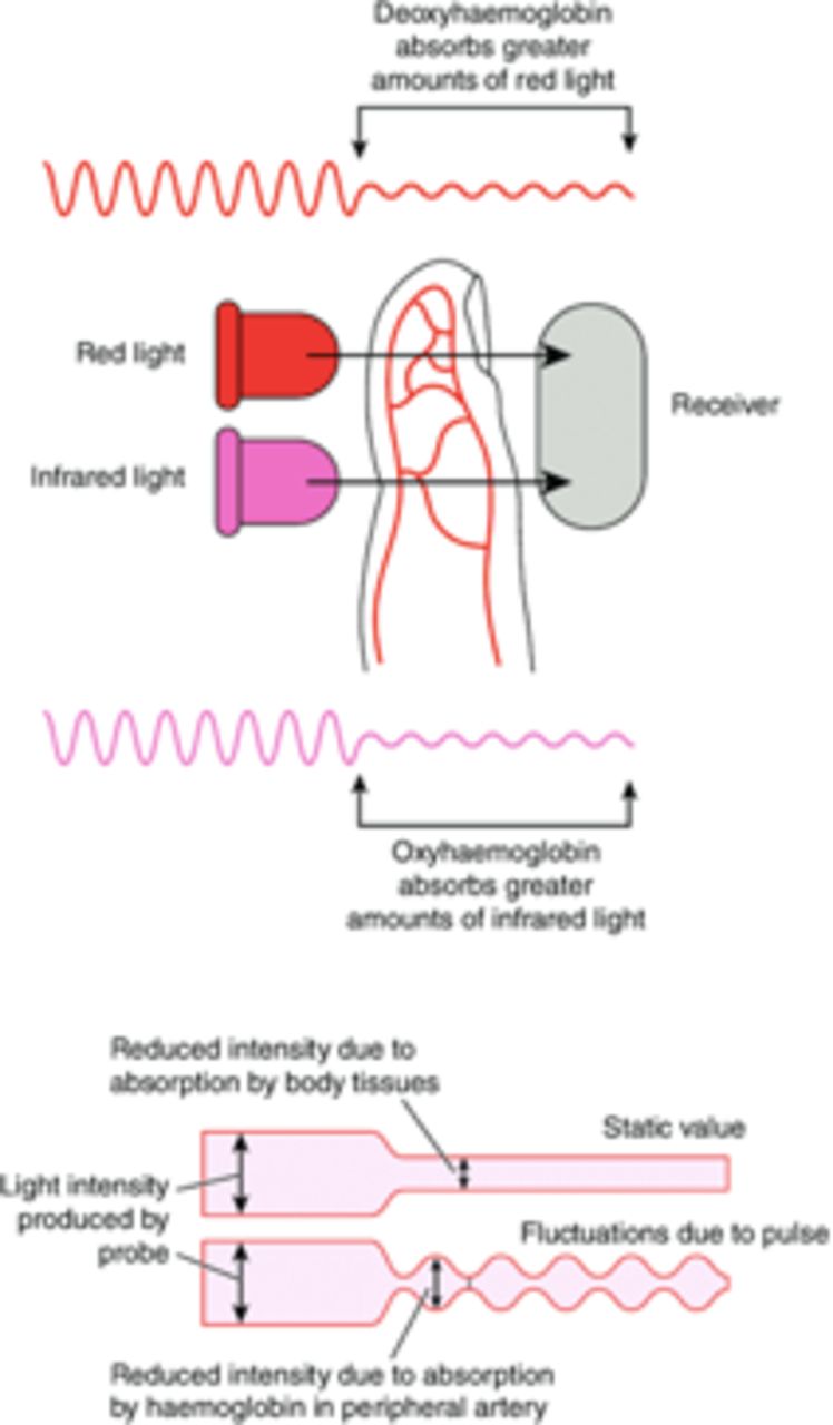 Use of pulse oximetry as an investigative test for paediatric