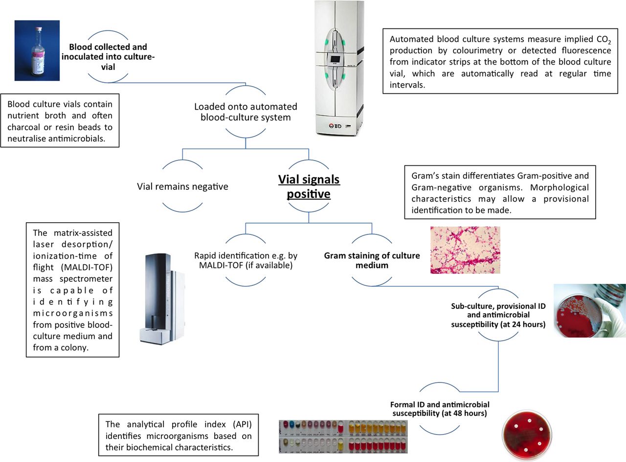 How to use… blood cultures ADC Education & Practice Edition