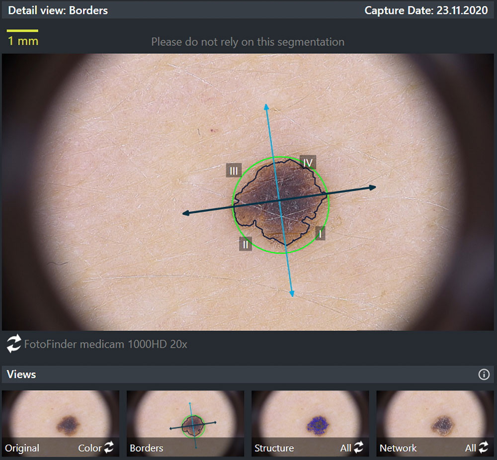 Recolectar 95+ images the mole clinic Viaterra.mx