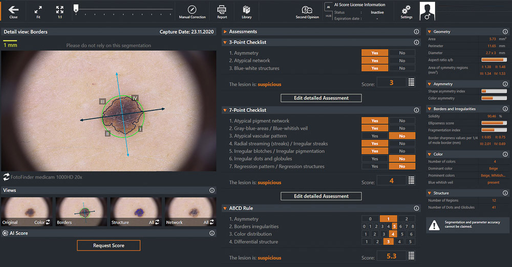 Mole Clinic in London Mole clinic near me EpicDermis